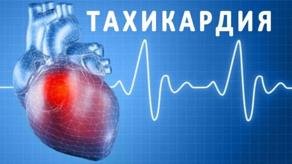 О тахикардии: почему данное заболевание считается опасным?