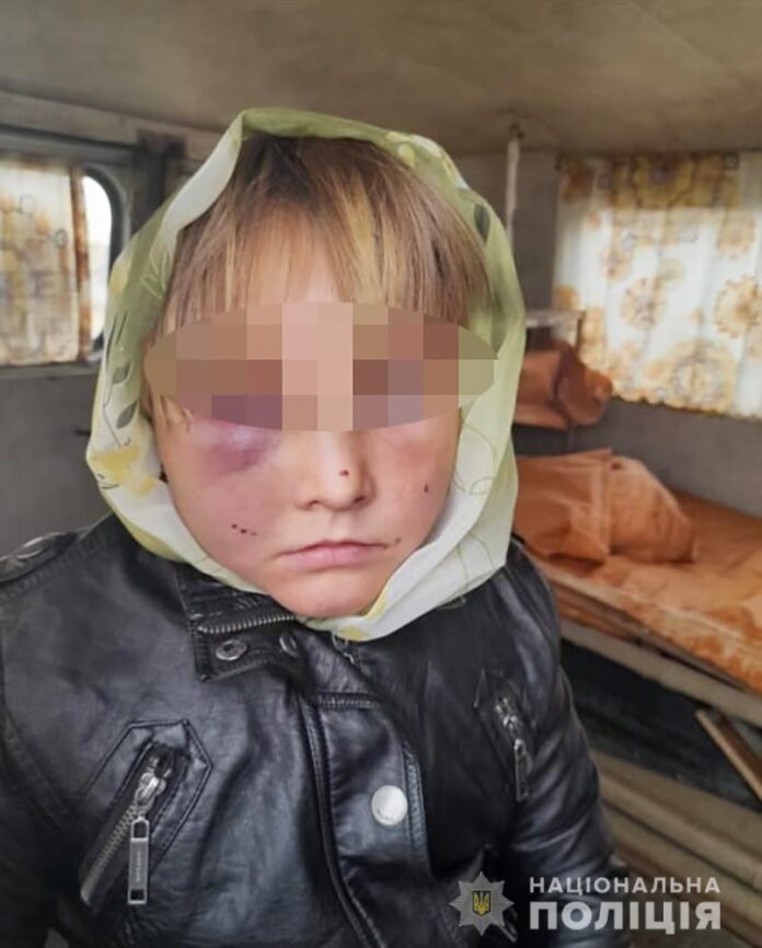 побив дитину