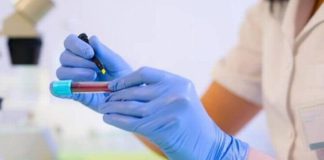 Тесты для определения пищевых аллергенов Тесты для определения пищевых аллергенов