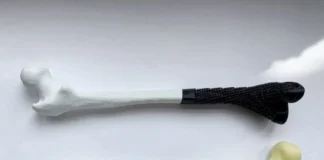 Переваги кісткових імплантатів створених 3D принтері Переваги кісткових імплантатів створених 3D принтері
