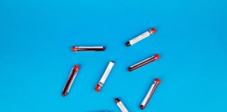 Що означають антитіла до тиреоглобуліну під час оцінки стану щитоподібної залози? Антитіла